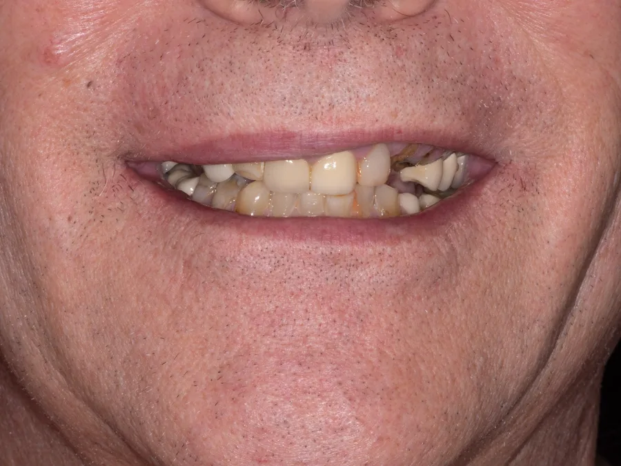 Smile before treatment, set 1