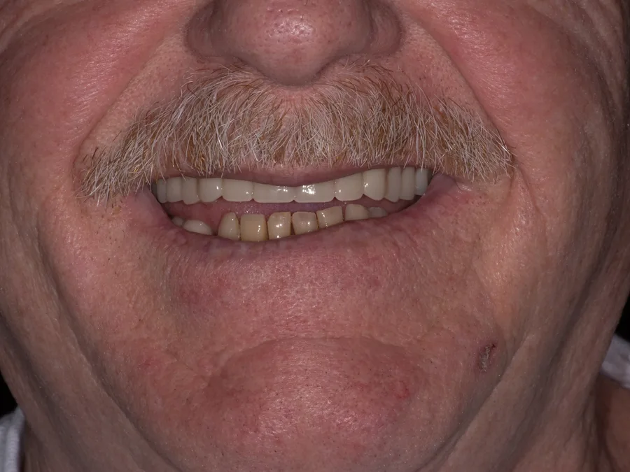 Smile before treatment, set 3
