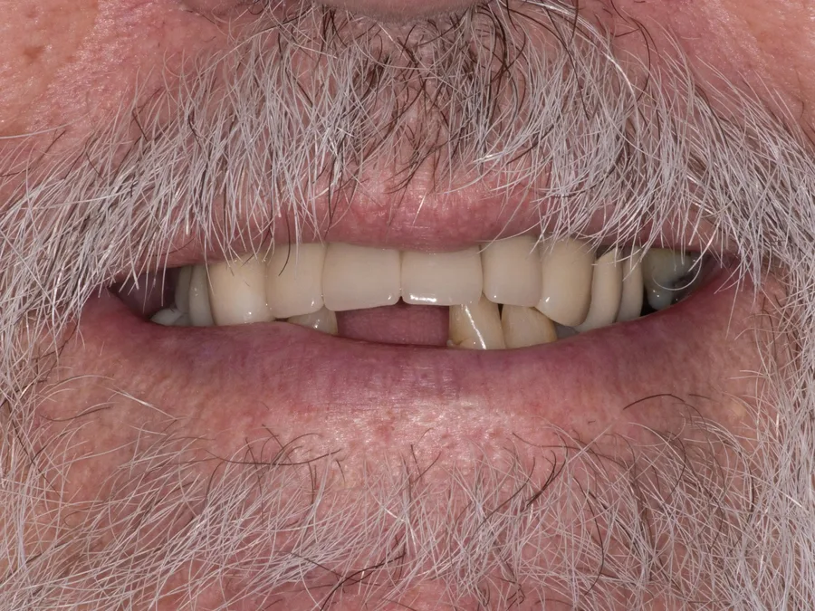 Smile before treatment, set 2